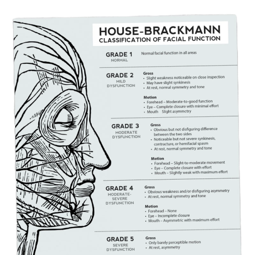 House-Brackmann